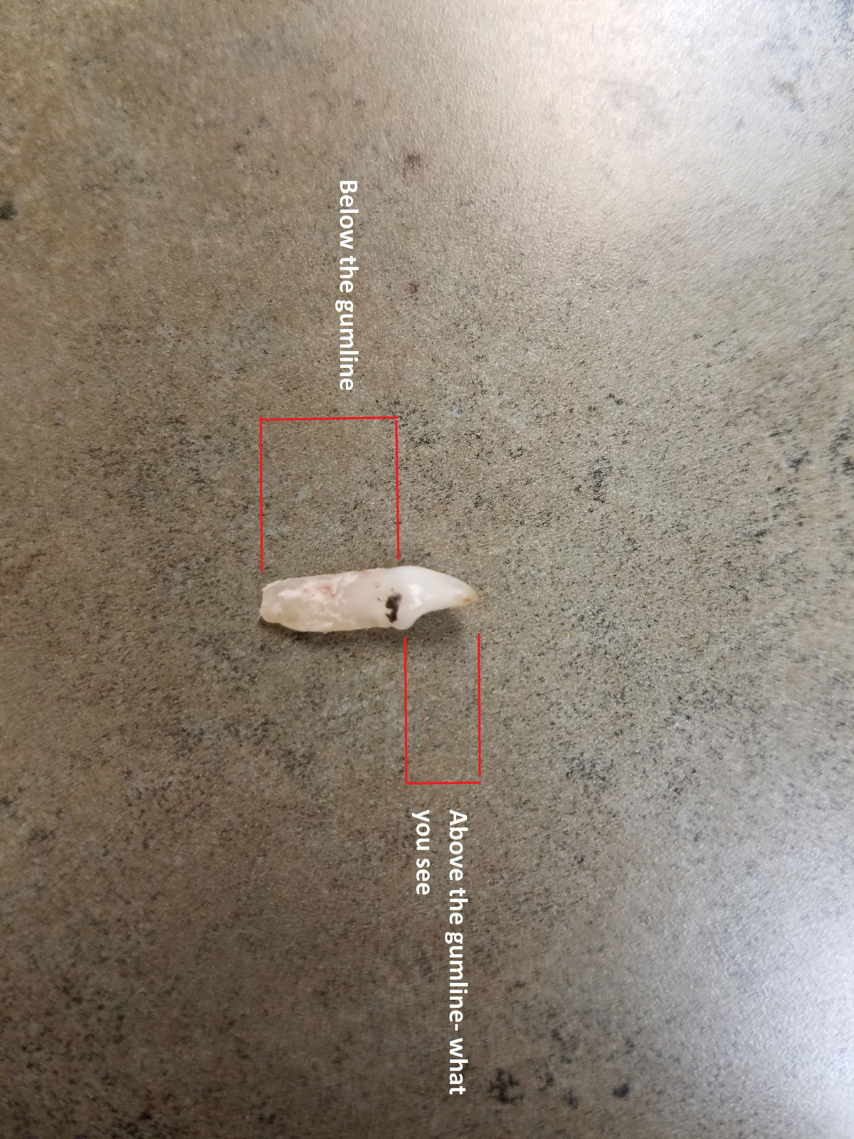 Tooth