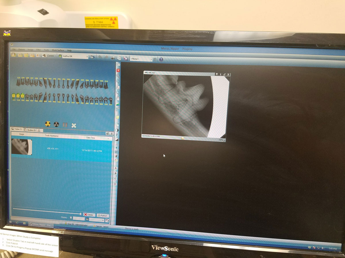 X-ray on monitor